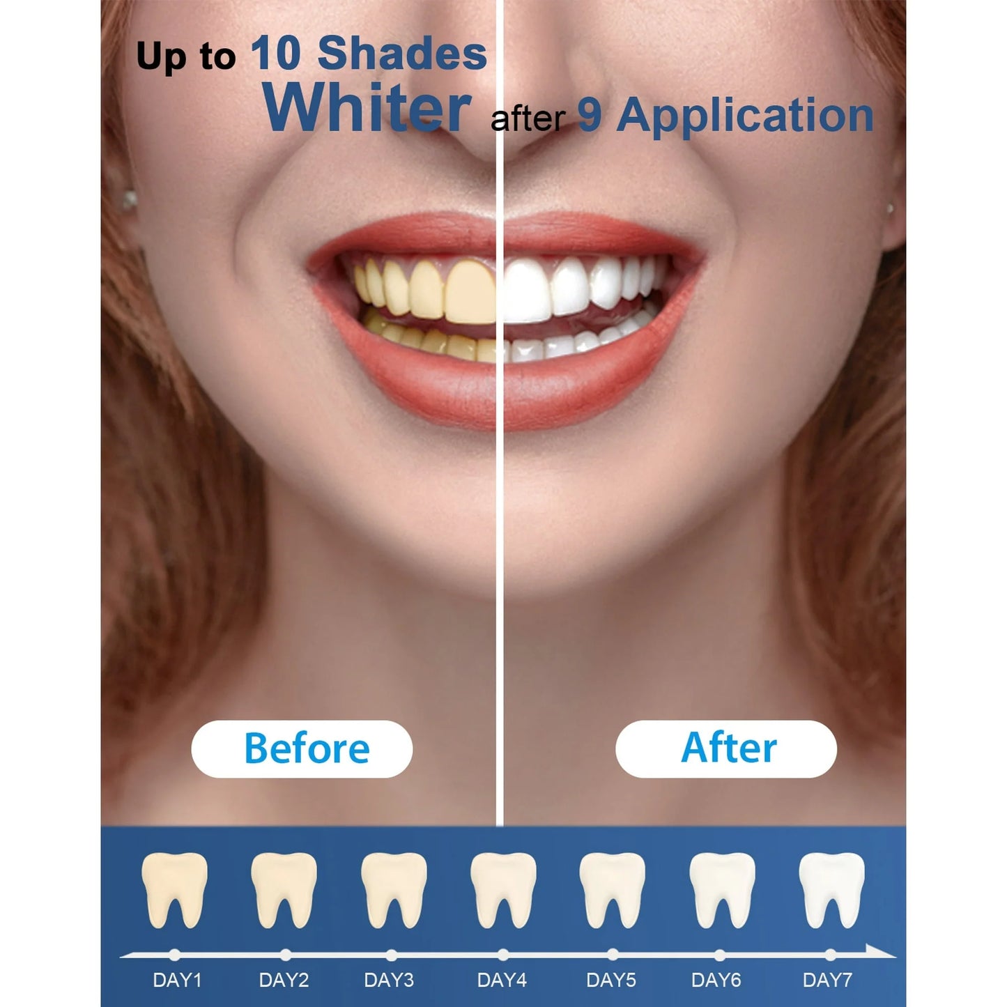 2PC Teeth Whitening Kit with 5-LED Light, 6Pc Opalescence Whitening Gel Powerful Formula,10 Min Fast Tooth Whitener